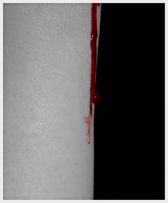 Blut und Blut...