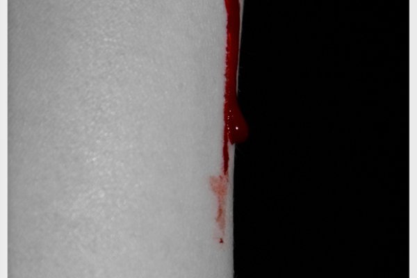 Blut und Blut...